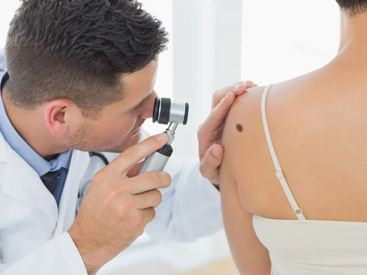 Stock photograph of models: a doctor examines a mole on a woman's shoulder with a dermatoscope