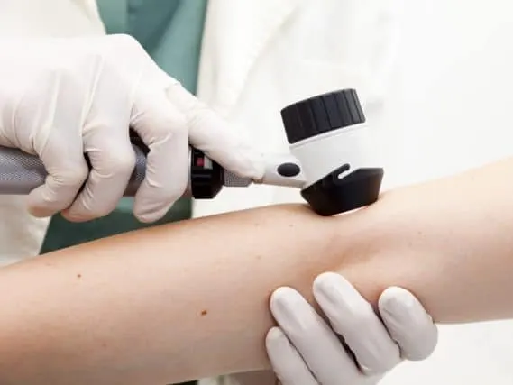 skin cancer screening