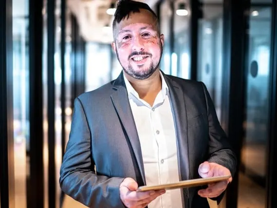 Stock photograph of a model: a smiling man in a grey blazer holding a tablet, with patches of lighter skin on his face