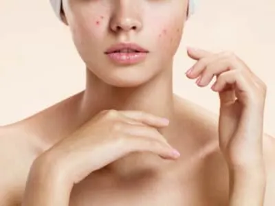 Stock photograph of a model: a woman in a white headband lying back with a thin layer of product peeling on her face