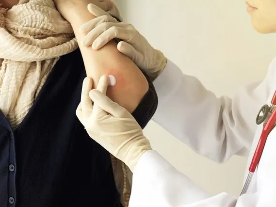 Dermatology clinical trial 