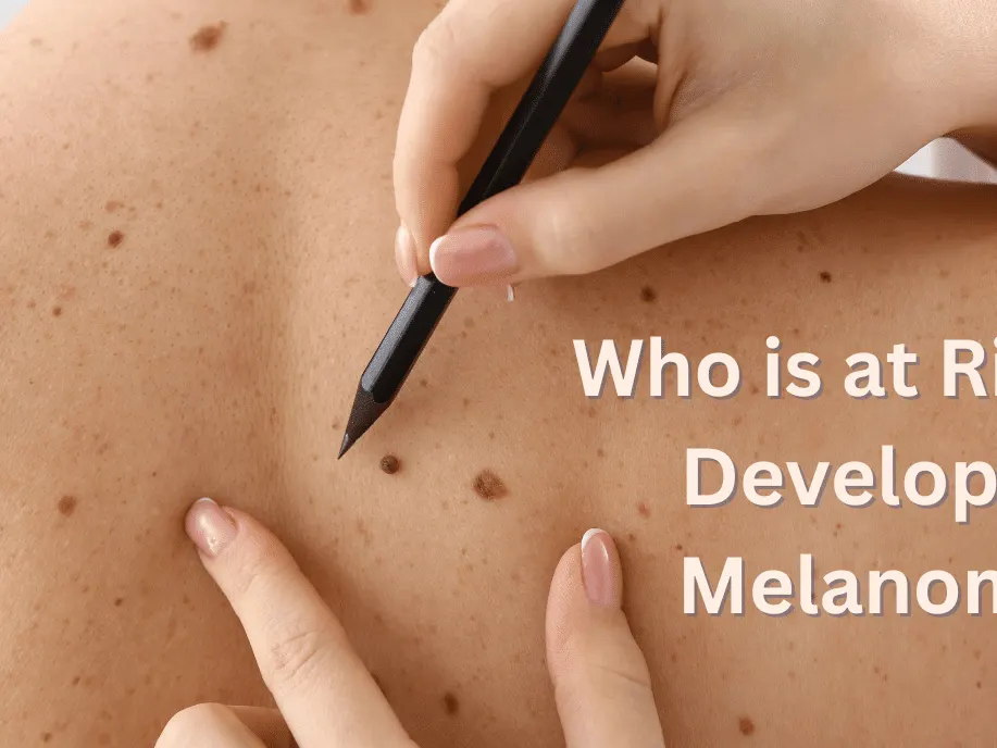 Graphic: Who is at Risk for Developing Melanoma? over a photo of a back with moles being pointed out with a pencil