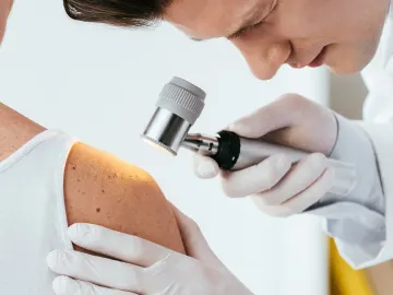 Melanoma Awareness Month: How to Spot the Warning Signs