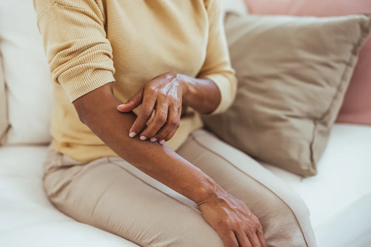 Stock photograph of a model: a woman in a yellow sweater seated on a sofa, touching the skin of her forearm