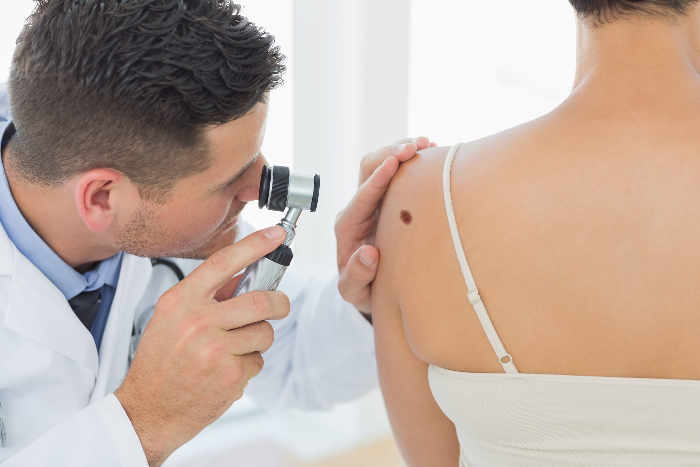 Stock photograph of models: a doctor examines a mole on a woman's shoulder with a dermatoscope