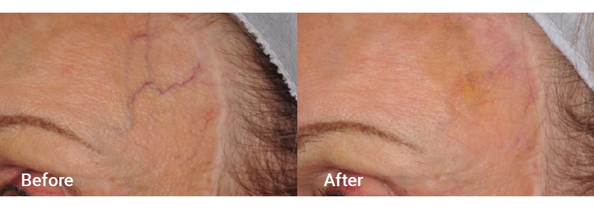 FADC Before & After Gallery Image 15