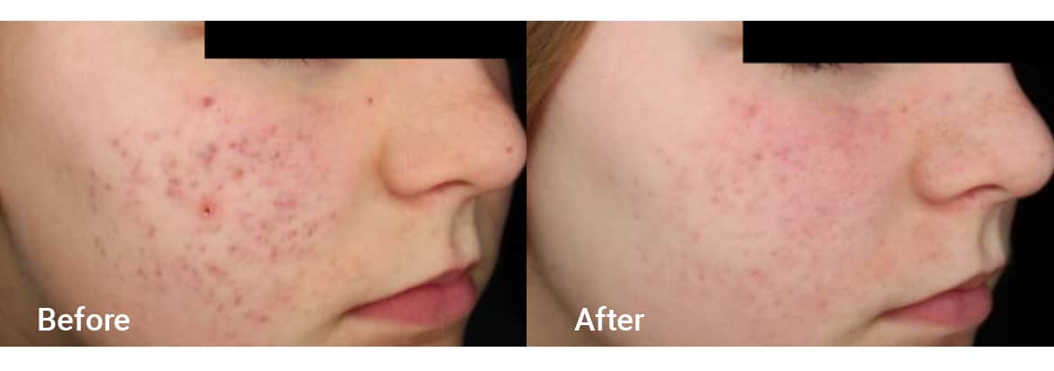 FADC Before & After Gallery Image 19