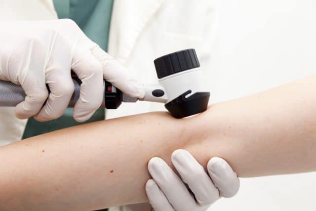 skin cancer screening