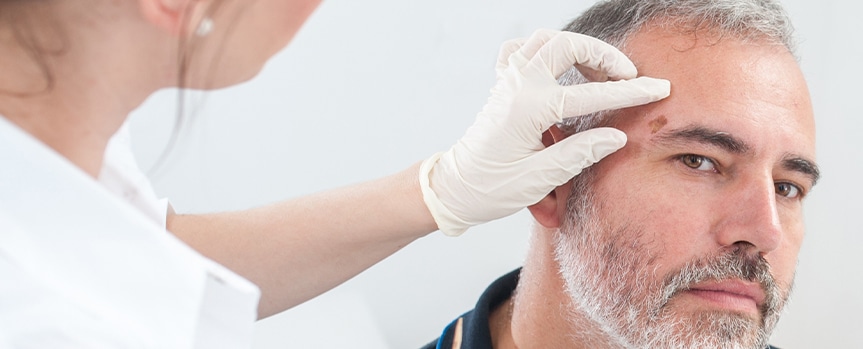female dermatologist examining male patient's mole above eyebrow