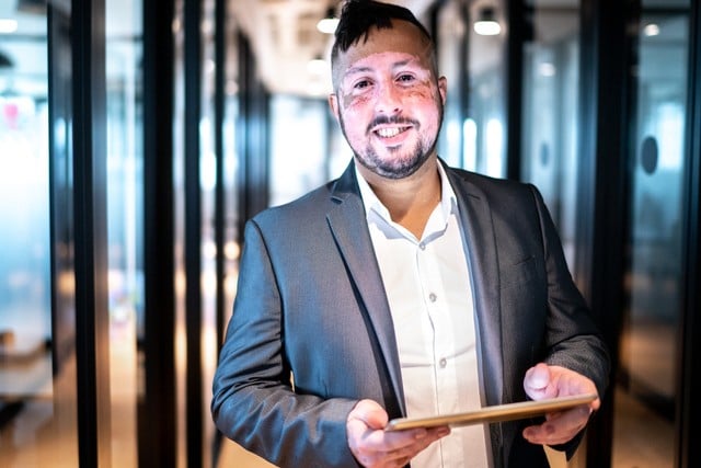 Stock photograph of a model: a smiling man in a grey blazer holding a tablet, with patches of lighter skin on his face