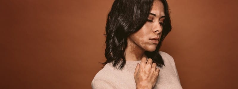 Stock photograph of a model: a dark-haired woman in a beige sweater against a brown backdrop, with lighter patches of skin on her face and hand