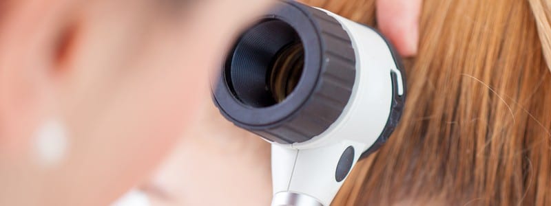 Stock photograph of a model: a clinician holding a dermatoscope up to a woman's ear and hair