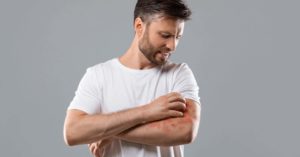 Annoyed middle-aged man in white t-shirt scratching itch on his arm