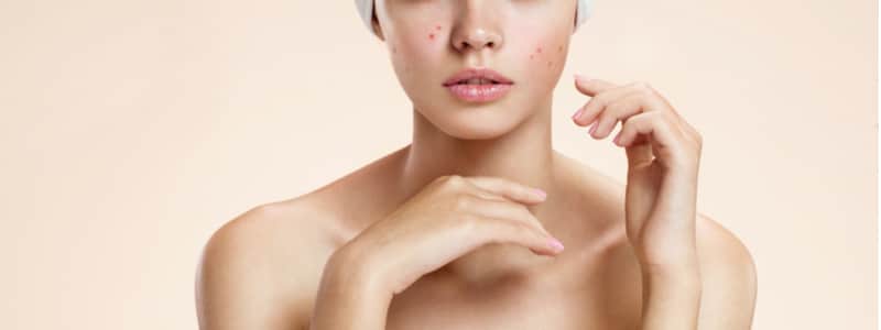Stock photograph of a model: a woman in a white headband lying back with a thin layer of product peeling on her face