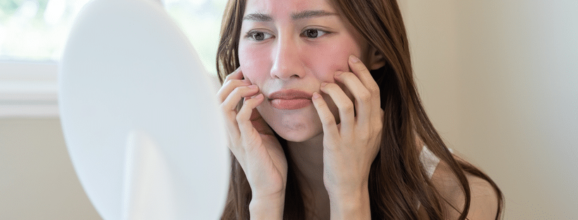 Stock photograph of a model: a woman with flushed, red cheeks touching her face while looking into a round mirror