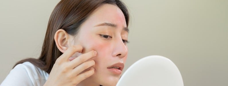 Stock photograph of a model: a young woman with reddened cheeks touching her face while looking into a hand mirror