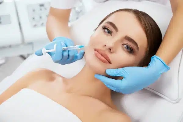 Filler for smile lines, smile lines filler, dermal fillers for smile lines, nasolabial flips, smile line correction
