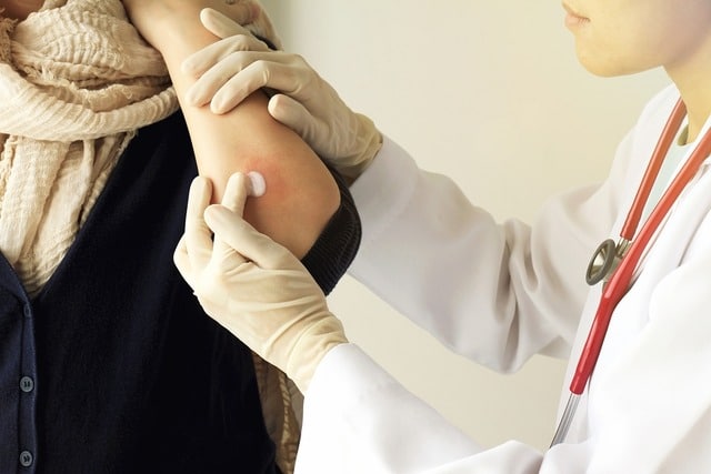 Dermatology clinical trial 