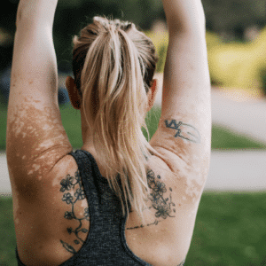Stock photograph of a model: a blonde woman with tattoos seen from behind, arms raised, with lighter patches of skin on arms and back