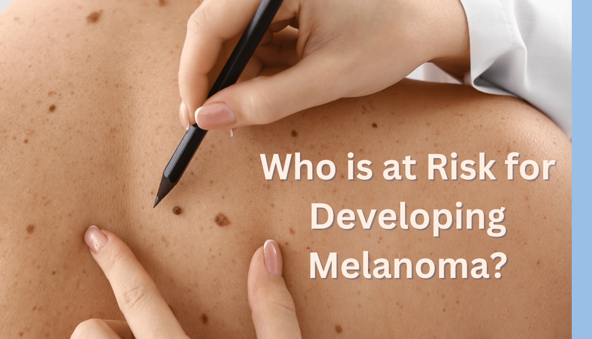 Graphic: Who is at Risk for Developing Melanoma? over a photo of a back with moles being pointed out with a pencil