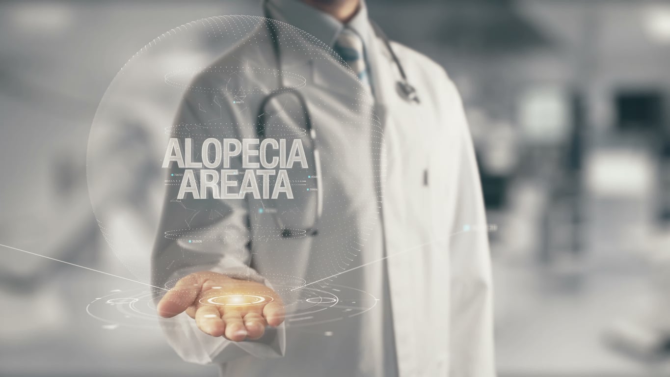 Is Alopecia Areata Caused By Hormone Changes