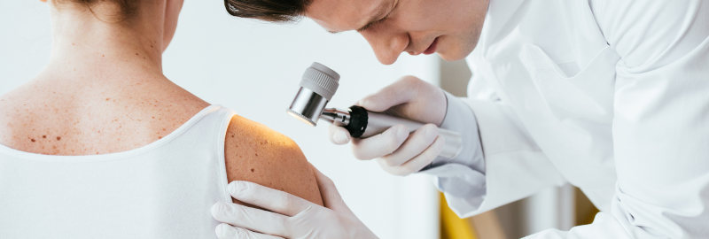 Melanoma Awareness Month: How to Spot the Warning Signs