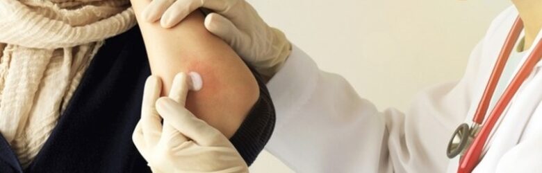 Dermatology clinical trial