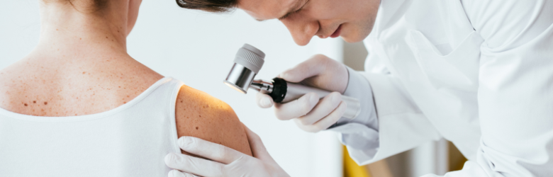 Melanoma Awareness Month: How to Spot the Warning Signs